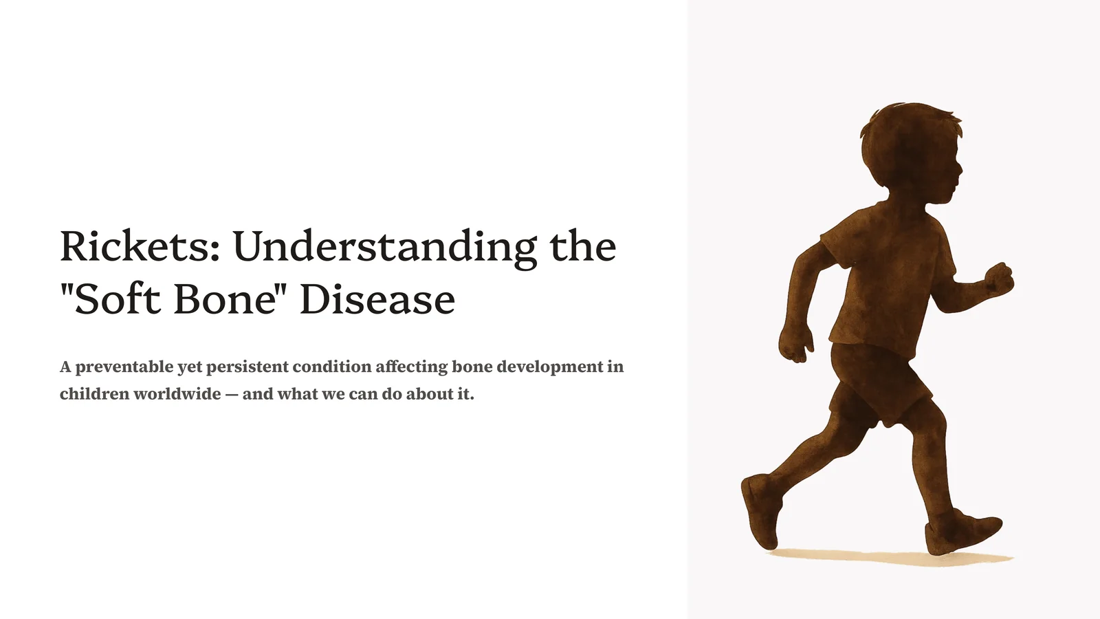 Rickets: Understanding the 