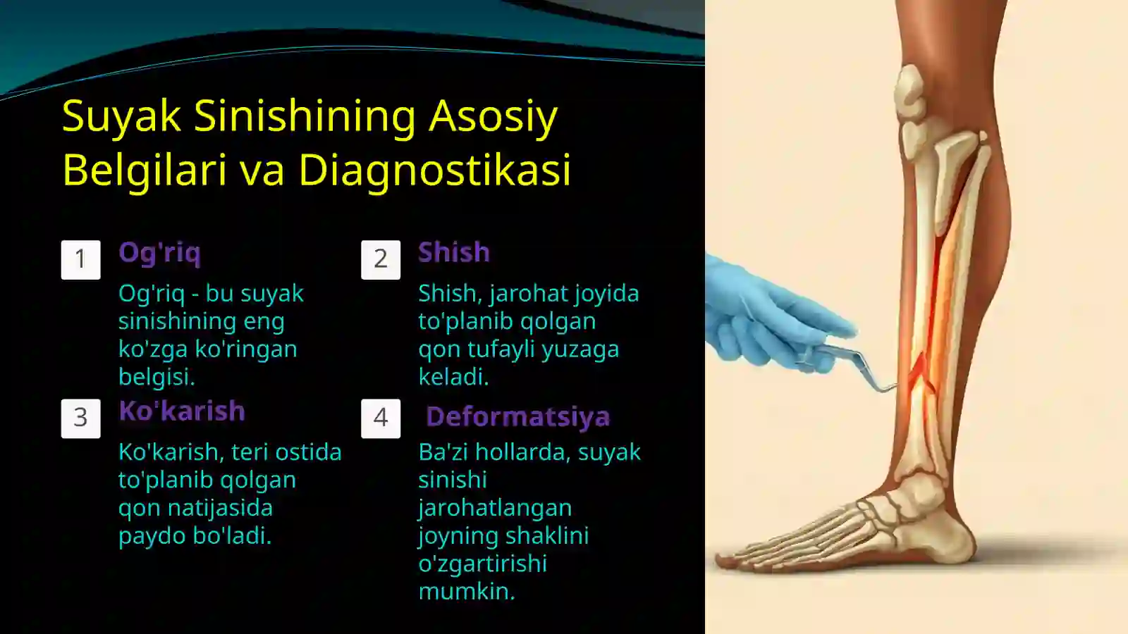 Suyak Sinishida Zamonaviy Davolash Usullari